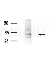 CLPP Antibody - Western blot analysis of extracts from EC304 cells
(heat-shock treatment), using CLPP Antibody at 1/1000 dilution.