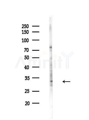 CLPP Antibody - Western blot analysis of lysates from EC304 cells(heat-shock treatment), using CLPP Antibody at 1/1000 dilution.