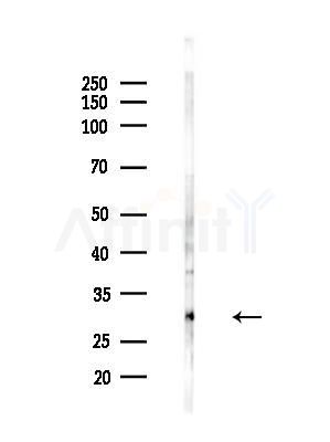 CLPP Antibody - Western blot analysis of lysates from B16F10-LUC cells(LPS,4h treatment), using CLPP Antibody at 1/1000 dilution.