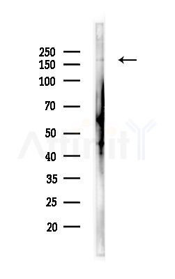 Brm Antibody - Western blot analysis of lysates from Hela cells(heat-shock,45min treatment), using Brm Antibody at 1/1000 dilution.