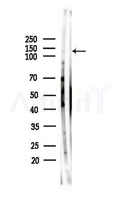 Cacna2d1 Antibody - Western blot analysis of lysates from HepG2 cells(starvation,24h treatment), using Cacna2d1 Antibody at 1/1000 dilution.