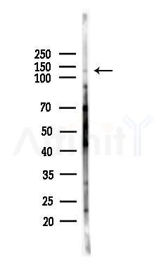 Cacna2d1 Antibody - Western blot analysis of lysates from HepG2 cells(starvation,24h treatment), using Cacna2d1 Antibody at 1/1000 dilution.