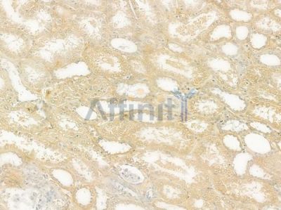 Calcitonin Antibody - DF8512 at 1/100 staining human normal kidney tissue by IHC-P.