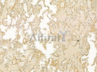 Calcitonin Antibody - DF8512 at 1/100 staining human normal lung tissue by IHC-P.