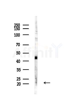Cardiotrophin-1 Antibody - Western blot analysis of lysates from Mouse liver, using Cardiotrophin-1 Antibody at 1/1000 dilution.