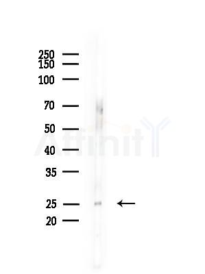 Cathepsin H Antibody - Western blot analysis of lysates from Mouse brain, using Cathepsin H Antibody at 1/1000 dilution.