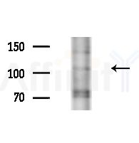 CD203c Antibody - Western blot analysis of lysates from A375 cells(heat-shock,45min treatment), using CD203c Antibody at 1/1000 dilution.