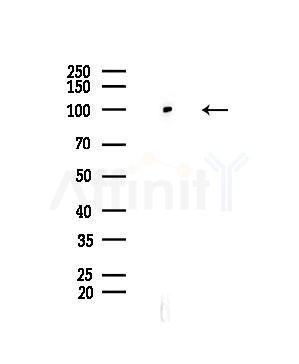 CHD1L Antibody - Western blot analysis of lysates from COLO205 cells(heat-shock,45min treatment), using CHD1L Antibody at 1/1000 dilution.