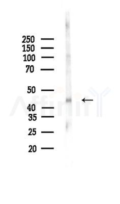 COLQ Antibody - Western blot analysis of lysates from EC304 cells, using COLQ Antibody at 1/1000 dilution.