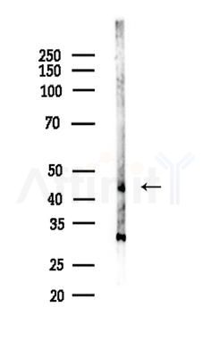 COLQ Antibody - Western blot analysis of lysates from COLO205 cells, using COLQ Antibody at 1/1000 dilution.