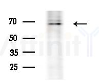 CTPS Antibody - Western blot analysis of extracts from Rat brain, using CTPS Antibody at 1/1000 dilution.