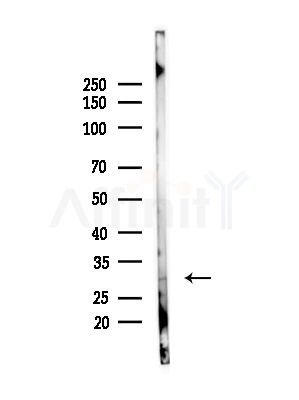 DIO3 Antibody - Western blot analysis of lysates from COLO203(UV,30min treatment), using DIO3 Antibody at 1/1000 dilution.