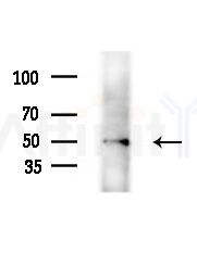 DP-2 Antibody - Western blot analysis of extracts from HepG2 cells(starvation,24h treatment), using DP-2 Antibody at 1/1000 dilution.