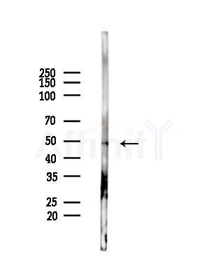 DP-2 Antibody - Western blot analysis of lysates from HepG2 cells(starvation,24h treatment), using DP-2 Antibody at 1/1000 dilution.