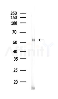 EAAT2 Antibody - Western blot analysis of lysates from Mouse liver, using EAAT2 Antibody at 1/1000 dilution.