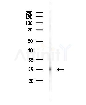 eEF1B2 Antibody - Western blot analysis of lysates from PC12 cells(UV,30min treatment), using eEF1B2 Antibody at 1/1000 dilution.