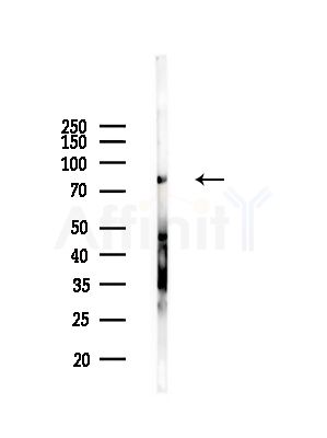Elmo1 Antibody - Western blot analysis of lysates from Mouse lung, using Elmo1 Antibody at 1/1000 dilution.