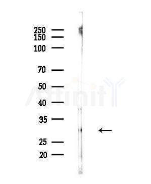 Endo G Antibody - Western blot analysis of lysates from B16F10-LUC cells(UV,30min treatment), using Endo G Antibody at 1/1000 dilution.