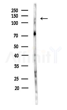 Erbin Antibody - Western blot analysis of lysates from Hela cells(heat-shock,45min treatment), using Erbin Antibody at 1/1000 dilution.