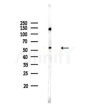 Fgl2 Antibody - Western blot analysis of lysates from Rat brain, using Fgl2 Antibody at 1/1000 dilution.
