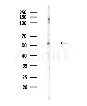Fgl2 Antibody - Western blot analysis of lysates from Mouse testis, using Fgl2 Antibody at 1/1000 dilution.