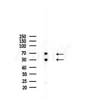 Fgl2 Antibody - Western blot analysis of lysates from A375 cells(starvation,24h treatment), using Fgl2 Antibody at 1/1000 dilution.