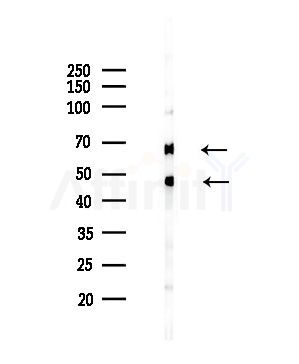 Fgl2 Antibody - Western blot analysis of lysates from HepG2 cells(LPS,4h treatment), using Fgl2 Antibody at 1/1000 dilution.