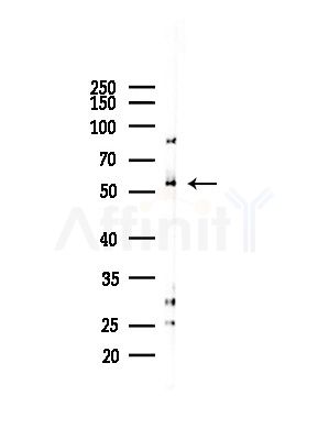 FucT-IV Antibody - Western blot analysis of lysates from COLO205 cells(heat-shock,45min treatment), using FucT-IV Antibody at 1/1000 dilution.