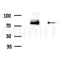 GCS alpha-1 Antibody - Western blot analysis of lysates from Mouse liver, using GCS alpha-1 Antibody at 1/1000 dilution.