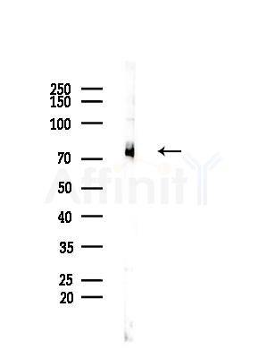 GCS alpha-1 Antibody - Western blot analysis of lysates from Mouse liver, using GCS alpha-1 Antibody at 1/1000 dilution.