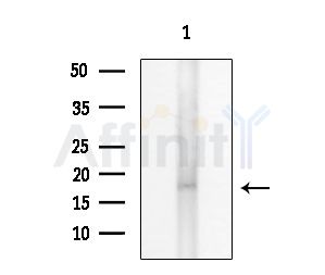 HES2 Antibody - Western blot analysis of extracts from Mouse brain, using HES2 Antibody at 1/1000 dilution.