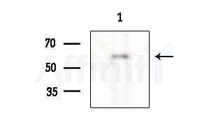 HIC-2 Antibody - Western blot analysis of extracts from EC304 cells, using HIC-2 Antibody at 1/1000 dilution.