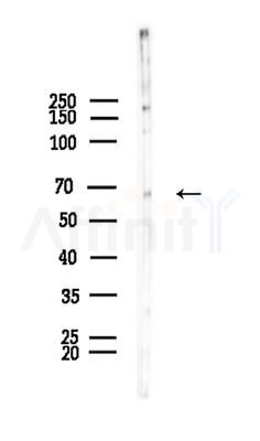 HIC-2 Antibody - Western blot analysis of lysates from EC304 cells, using HIC-2 Antibody at 1/1000 dilution.