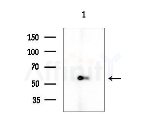 HLA-G Antibody - Western blot analysis of extracts from EC304 cells, using HLA-G Antibody at 1/1000 dilution.