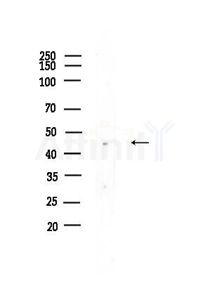 HLA-G Antibody - Western blot analysis of lysates from EC304 cells, using HLA-G Antibody at 1/1000 dilution.