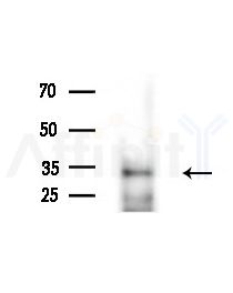 HoxB4 Antibody - Western blot analysis of extracts from Mouse liver, using HoxB4 Antibody at 1/1000 dilution.