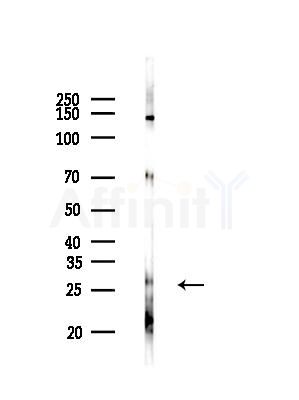 HoxB4 Antibody - Western blot analysis of lysates from Mouse liver, using HoxB4 Antibody at 1/1000 dilution.