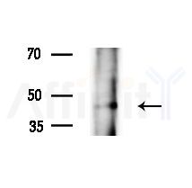 IDH2 Antibody - Western blot analysis of extracts from A375 cells(heat-shock,45min treatment), using IDH2 Antibody at 1/1000 dilution.