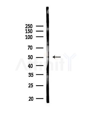 IDH2 Antibody - Western blot analysis of lysates from A375 cells(heat-shock,45min treatment), using IDH2 Antibody at 1/1000 dilution.