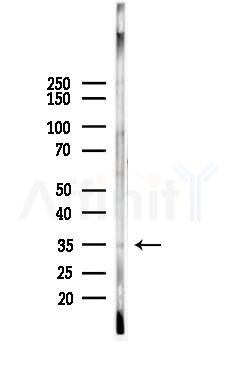 IgA Antibody - Western blot analysis of lysates from Mouse brain, using IgA Antibody at 1/1000 dilution.