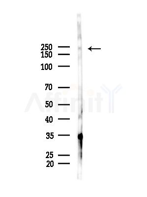 Nav1.6/SCN8A Antibody - Western blot analysis of lysates from RAW264.