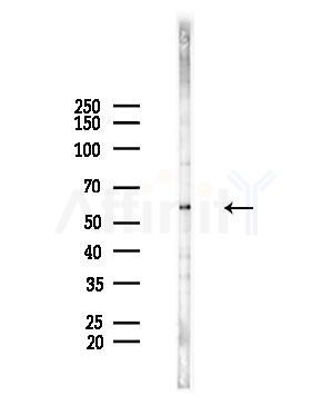 SLC22A6 Antibody - Western blot analysis of lysates from COLO205 cells(heat-shock,45min treatment), using SLC22A6 Antibody at 1/1000 dilution.