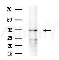 OBCAM Antibody - Western blot analysis of extracts from Mouse liver, using OBCAM Antibody at 1/1000 dilution.