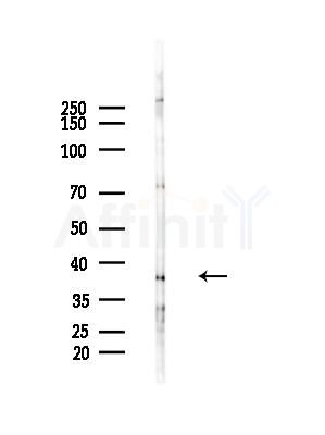 OBCAM Antibody - Western blot analysis of lysates from Mouse liver, using OBCAM Antibody at 1/1000 dilution.