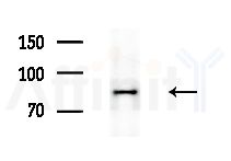 OPA1 Antibody - Western blot analysis of extracts from HepG2 cells(heat-shock treatment), using OPA1 Antibody at 1/1000 dilution.