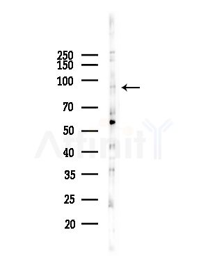 OPA1 Antibody - Western blot analysis of lysates from HepG2 cells(heat-shock,45min treatment), using OPA1 Antibody at 1/1000 dilution.