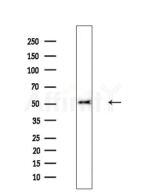 PANK2 Antibody - Western blot analysis of lysates from MDA-MB-231 cells(heat-shock,45min treatment), using PANK2 Antibody at 1/1000 dilution.