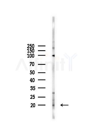 PGE synthase Antibody - Western blot analysis of lysates from A375 cells(starvation,24h treatment), using PGE synthase Antibody at 1/1000 dilution.