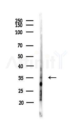 PP2A-C alpha/beta Antibody - Western blot analysis of lysates from MCF7 cells(heat-shock,45min treatment), using PP2A-C alpha/beta Antibody at 1/1000 dilution.