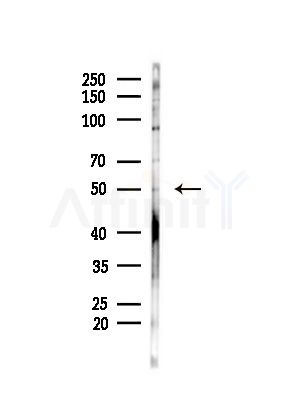 RBMS3 Antibody - Western blot analysis of lysates from MDA-MB-231 cells(heat-shock,45min treatment), using RBMS3 Antibody at 1/1000 dilution.
